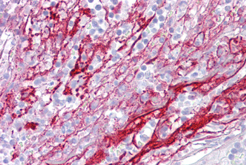 APOH Rabbit Polyclonal Antibody