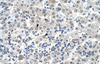 CDR2 Rabbit Polyclonal Antibody