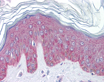 IL33 Rabbit Polyclonal Antibody
