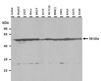 NAGS Rabbit Polyclonal Antibody