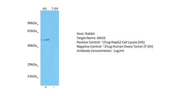 NAGS Rabbit Polyclonal Antibody