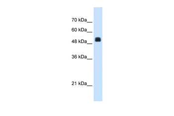 NAGS Rabbit Polyclonal Antibody