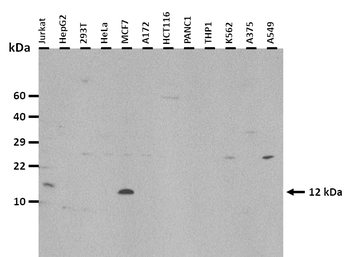 MGP Rabbit Polyclonal Antibody