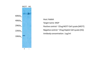MGP Rabbit Polyclonal Antibody