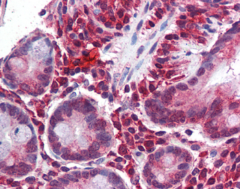 MGP Rabbit Polyclonal Antibody