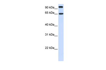 NTRK3 Rabbit Polyclonal Antibody