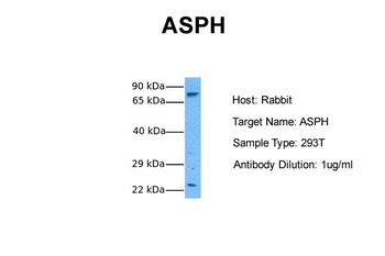ASPH Rabbit Polyclonal Antibody
