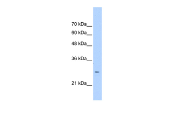 ASPH Rabbit Polyclonal Antibody