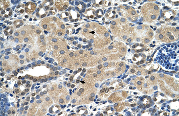 ASPH Rabbit Polyclonal Antibody
