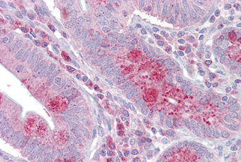 OAS1 Rabbit Polyclonal Antibody