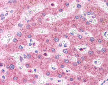 HNF1A Rabbit Polyclonal Antibody