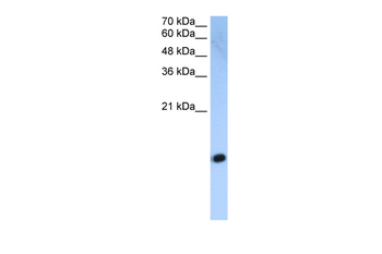 HIST2H2AC Rabbit Polyclonal Antibody