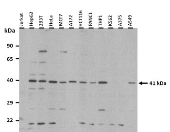 EME2 Rabbit Polyclonal Antibody