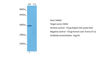 EME2 Rabbit Polyclonal Antibody