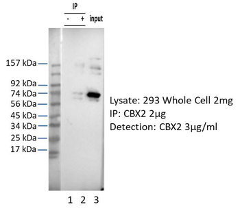 CBX2 Rabbit Polyclonal Antibody