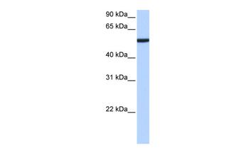 CBX2 Rabbit Polyclonal Antibody