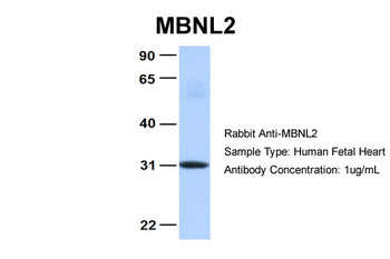 MBNL2 Rabbit Polyclonal Antibody