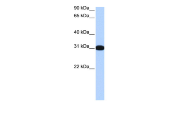 MBNL2 Rabbit Polyclonal Antibody