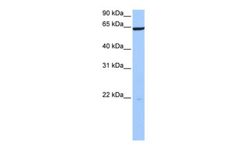PAXIP1 Rabbit Polyclonal Antibody
