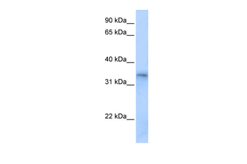 FHL5 Rabbit Polyclonal Antibody