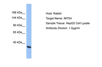 INTS4 Rabbit Polyclonal Antibody
