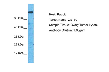 ZNF160 Rabbit Polyclonal Antibody