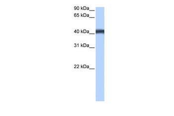 MFSD3 Rabbit Polyclonal Antibody