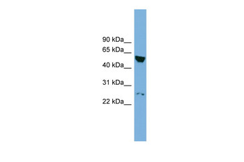 DEPDC7 Rabbit Polyclonal Antibody