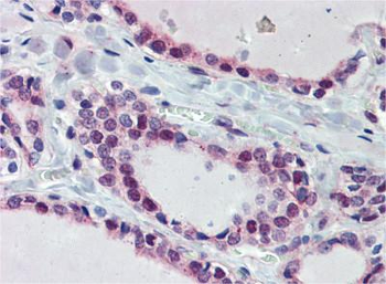 FUBP3 Rabbit Polyclonal Antibody
