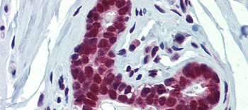 FUBP3 Rabbit Polyclonal Antibody