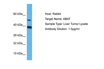 ABAT Rabbit Polyclonal Antibody