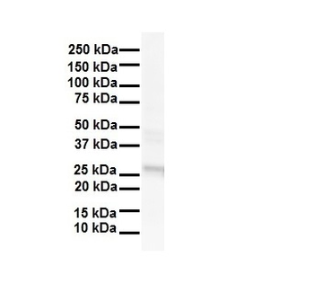 LKAAEAR1 Rabbit Polyclonal Antibody