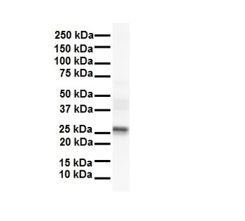LKAAEAR1 Rabbit Polyclonal Antibody
