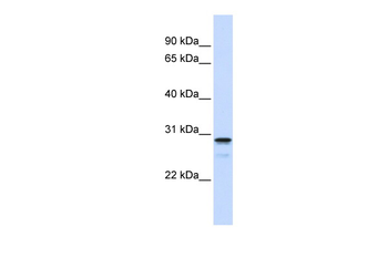 FAM78B Rabbit Polyclonal Antibody