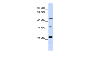 FAM153B Rabbit Polyclonal Antibody