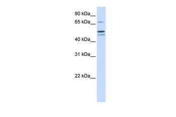 EARS2 Rabbit Polyclonal Antibody