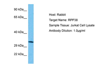 RPP38 Rabbit Polyclonal Antibody