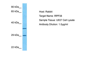 RPP38 Rabbit Polyclonal Antibody