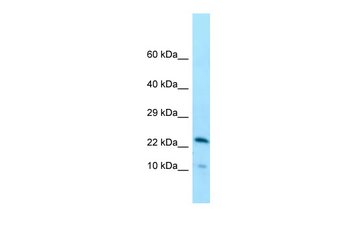 CCDC43 Rabbit Polyclonal Antibody