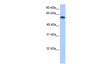 CYP11A1 Rabbit Polyclonal Antibody