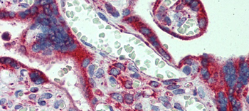 CYP11A1 Rabbit Polyclonal Antibody