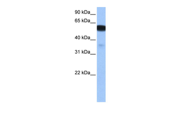 NHEDC1 Rabbit Polyclonal Antibody