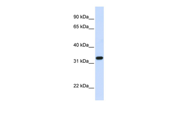 TBCB Rabbit Polyclonal Antibody