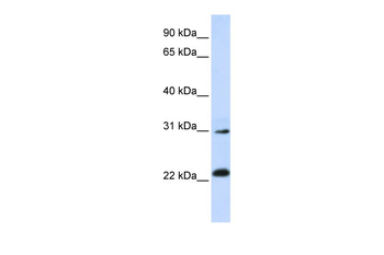 AP3S1 Rabbit Polyclonal Antibody