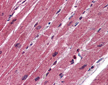 CPN1 Rabbit Polyclonal Antibody