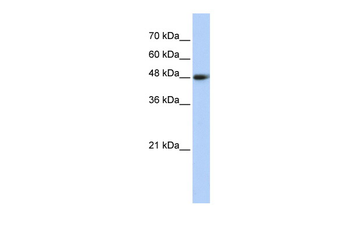 CPN1 Rabbit Polyclonal Antibody
