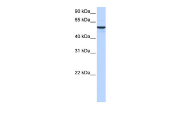 DPH2 Rabbit Polyclonal Antibody