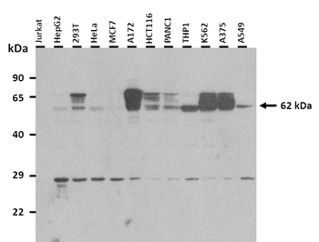 DPYSL3 Rabbit Polyclonal Antibody