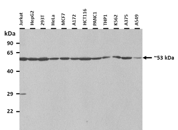 CHN1 Rabbit Polyclonal Antibody