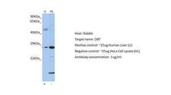 DBT Rabbit Polyclonal Antibody